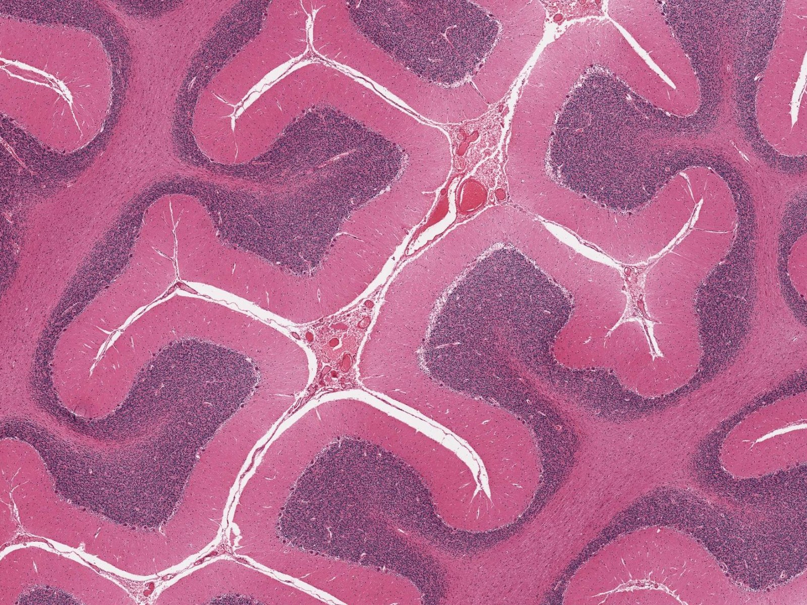 Microscopic view of a stained human cerebellum tissue sample showing its folded tissue architecture.