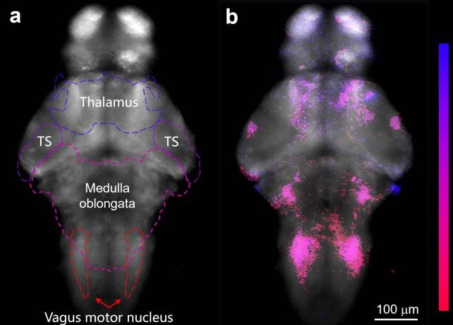 Scientists Used Light to Wiggle a Fish's Ear Stones, And You'll Never Guess Why