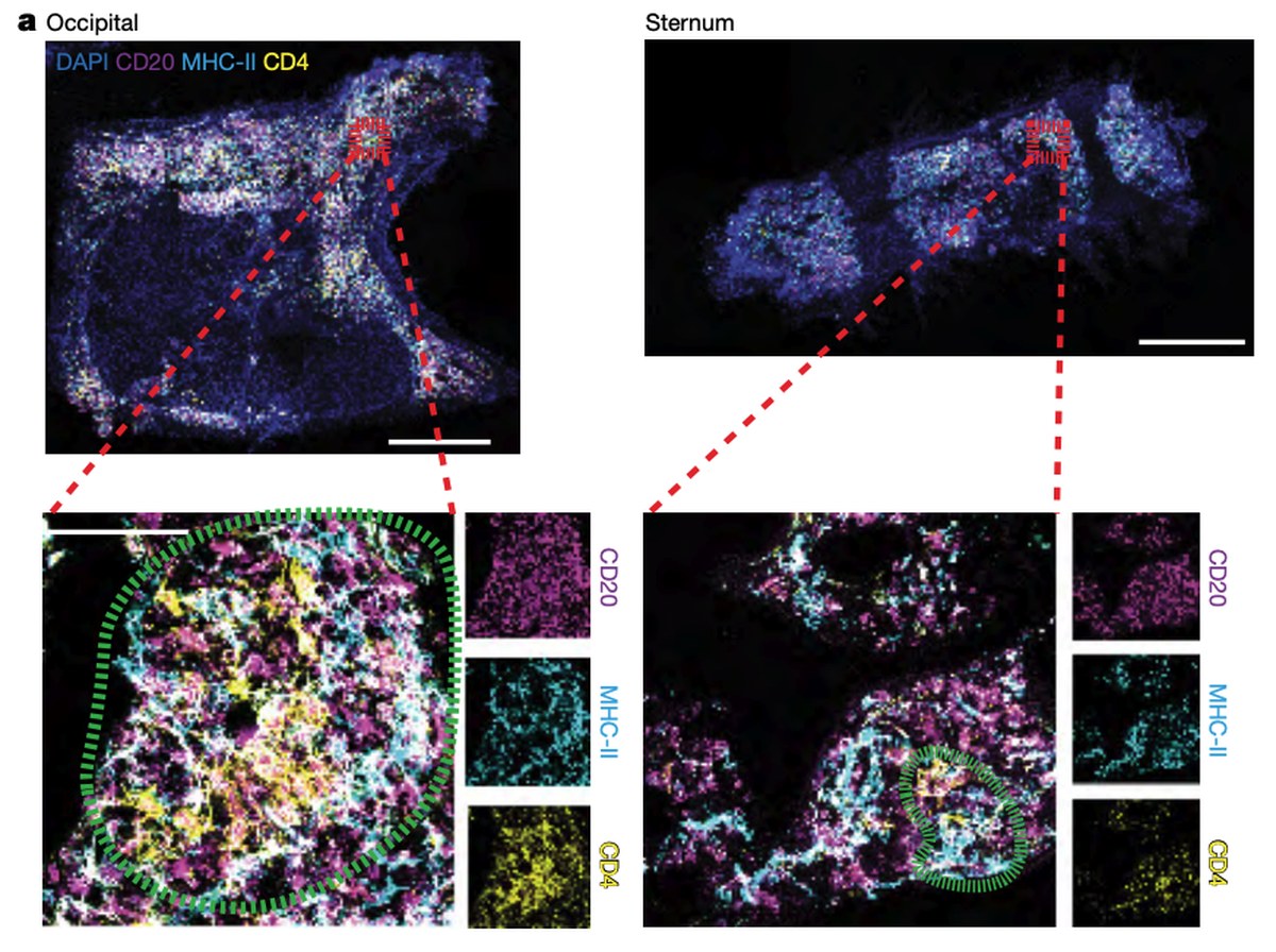 Scientists Discover a New Organ Hiding in The Skull