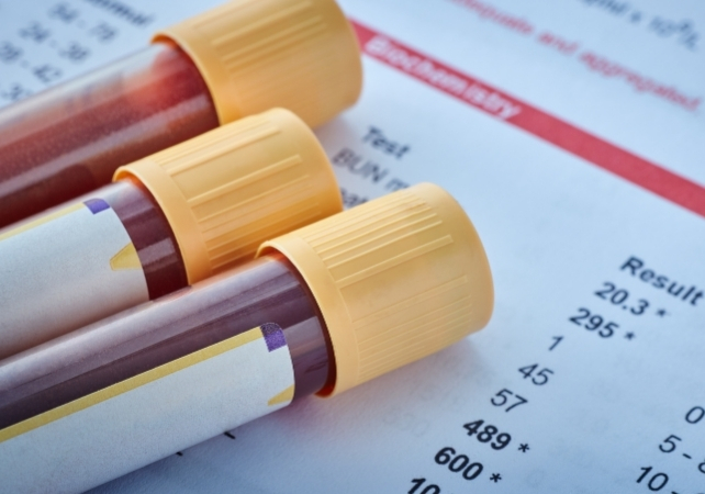 A Simple Blood Test Could Reveal Your Chances of Dying in The Next Decade
