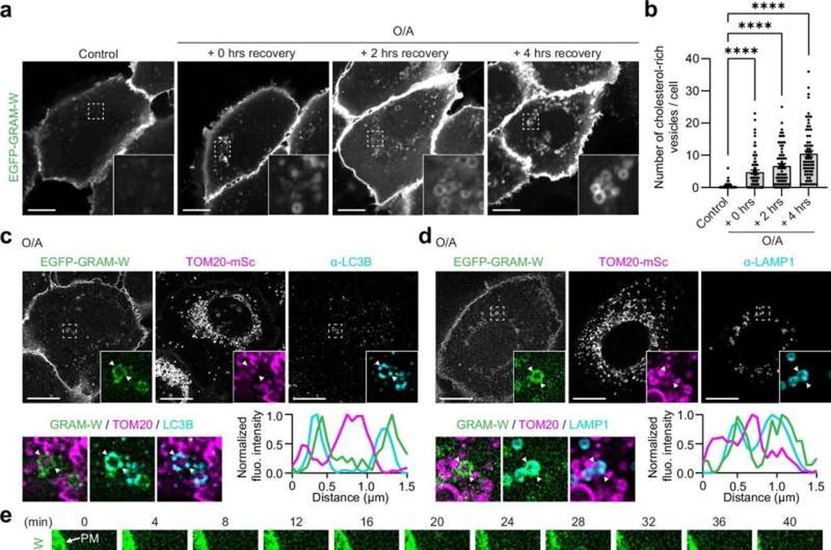 Unlocking the cell's supply chain: How cholesterol keeps cellular recycling centers running
