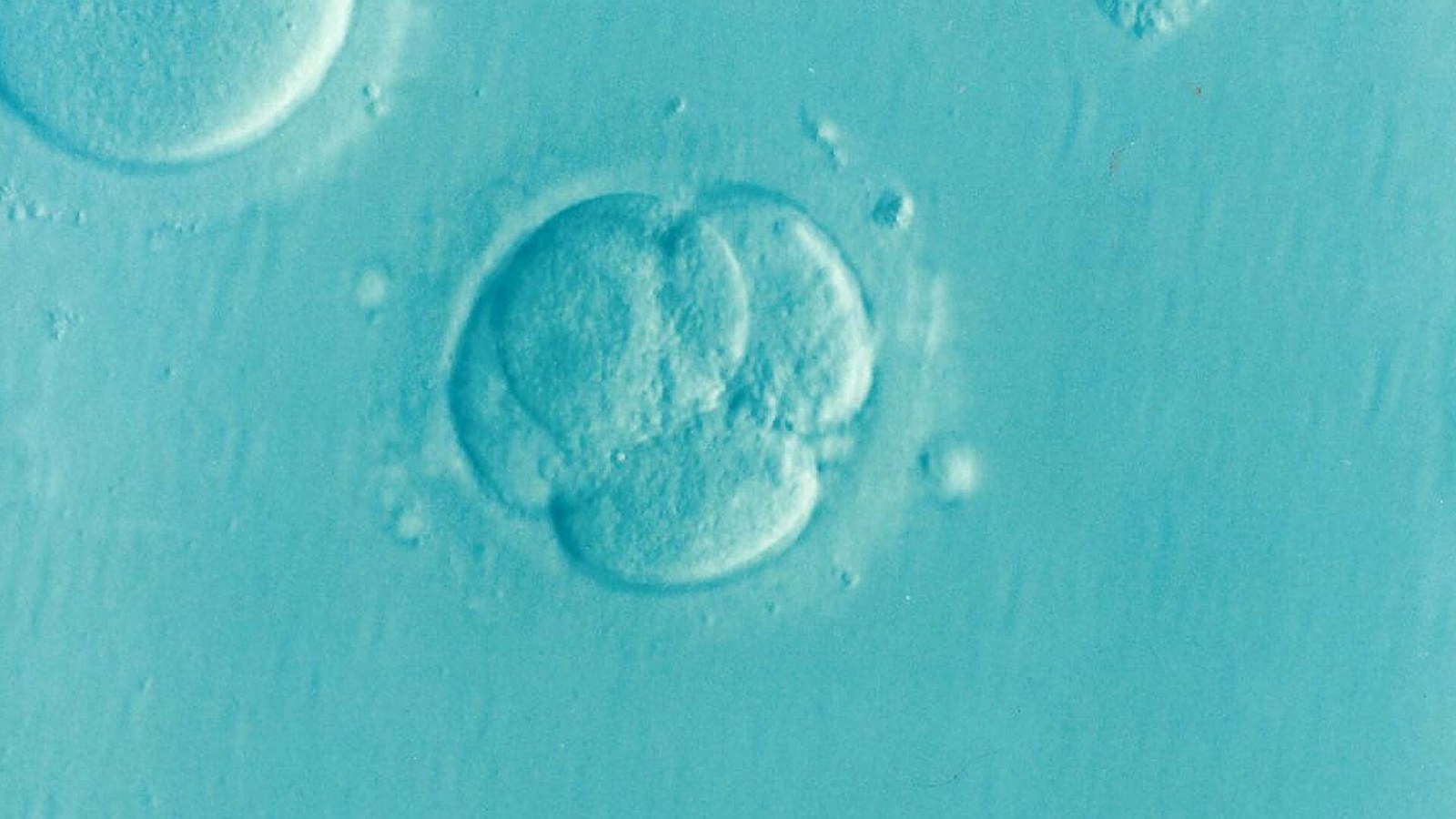 Human embryo base editing can reach all cells but causes unpredictable genetic changes