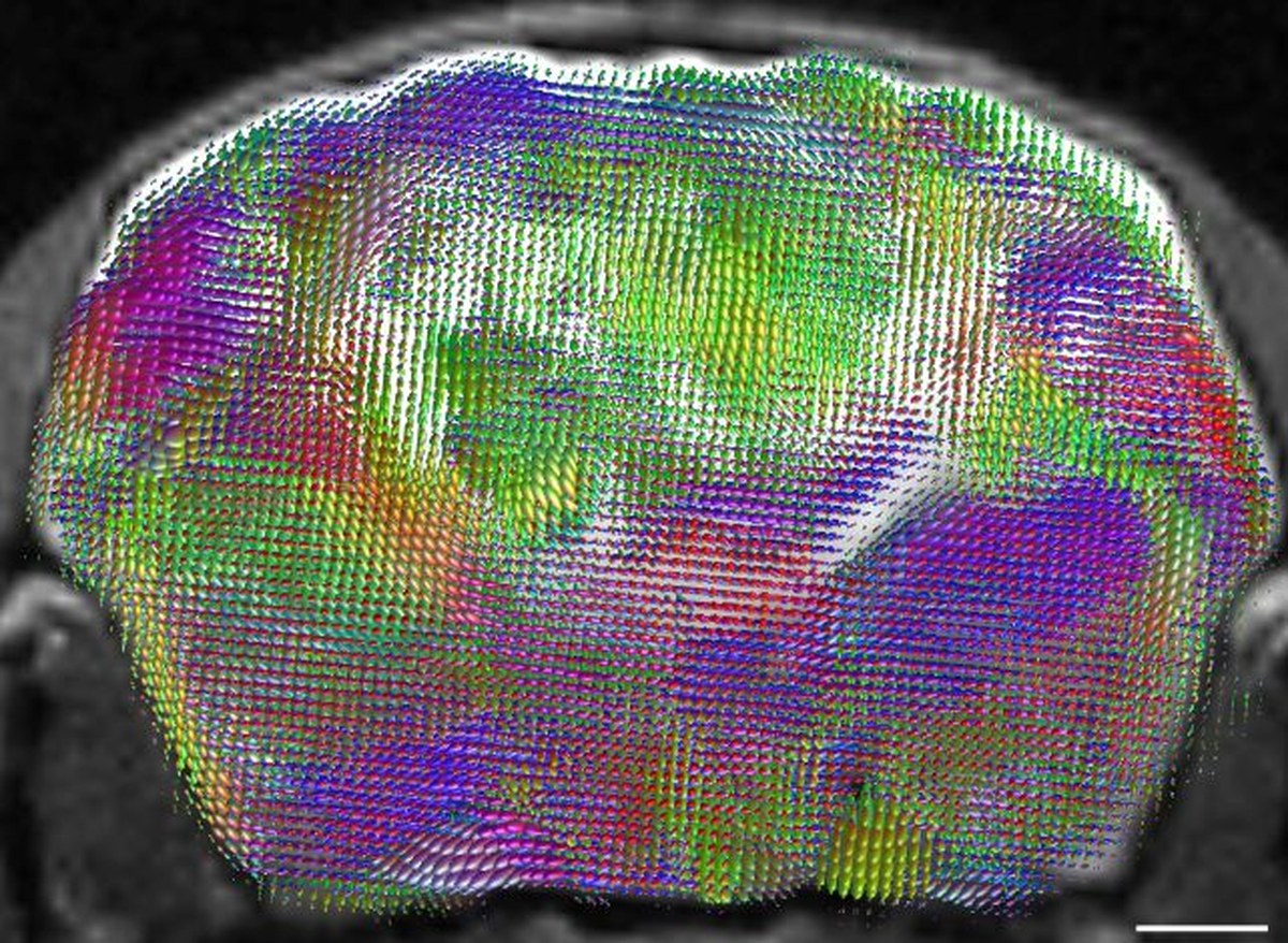 Scientists Replaced Mouse Cortices With Human Brain Tissue. Here's What Happened.