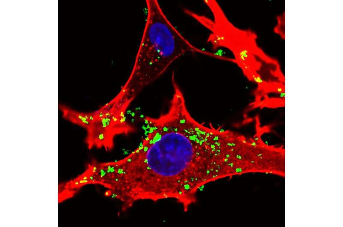 The new nanoparticles can be heated using infrared light, release antioxidant substances, and electrically stimulate cells when activated by ultrasound. Credit: IIT-Istituto Italiano di Tecnologia They heat, heal and stimulate cells: IIT's new nanoparticles for nanomedicine