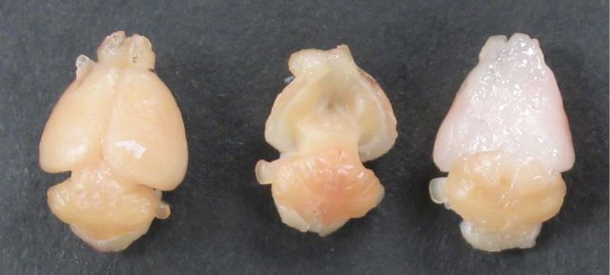 Scientists Replaced Mouse Cortices With Human Brain Tissue. Here's What Happened.