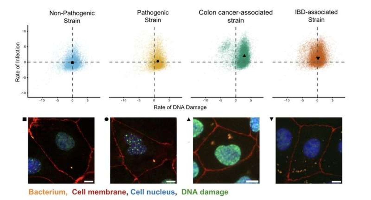 Cell by cell: New machine-learning-based method reveals what can make bacteria dangerous