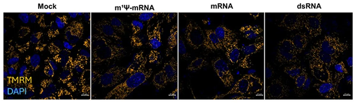 mRNA results