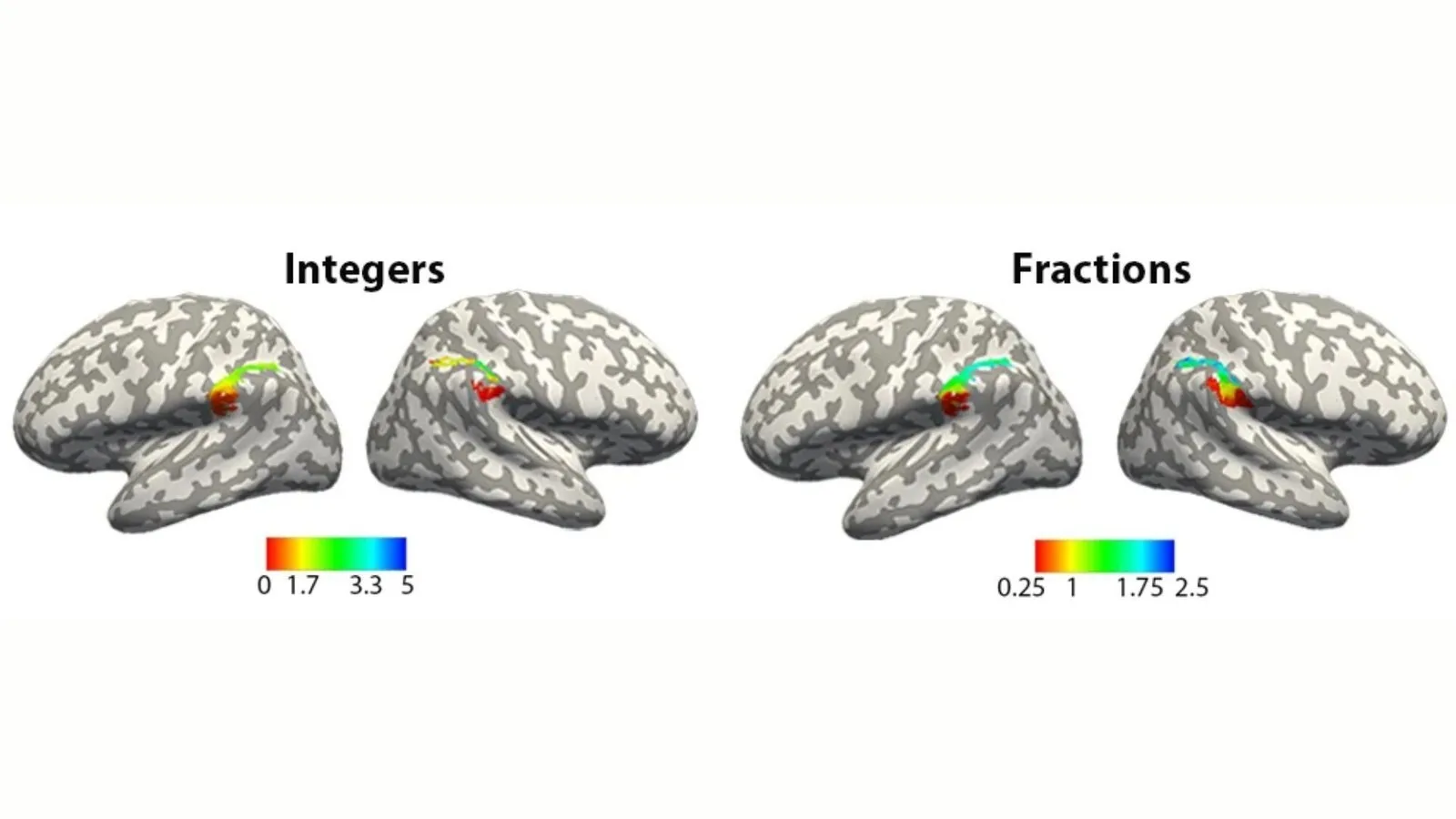 3D scans of brains with various colors showing different areas lighting up during activity.