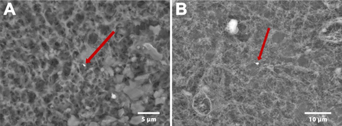 Metal particles