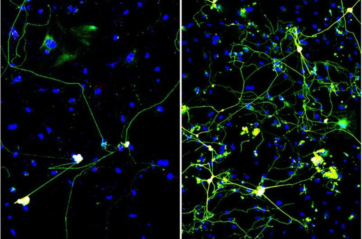 A quick squeeze helps CRISPR turn skin cells into neurons more efficiently