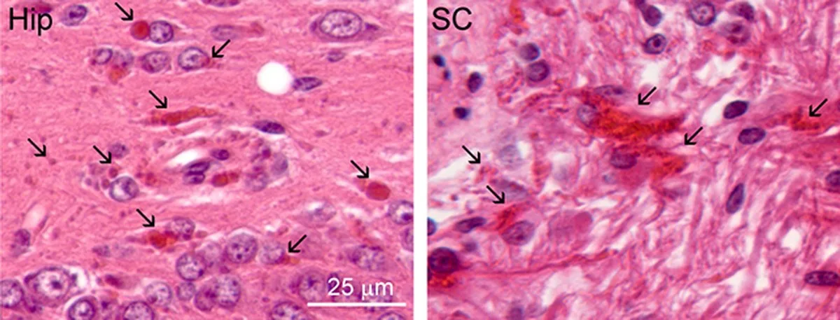 Mouse brain fibers