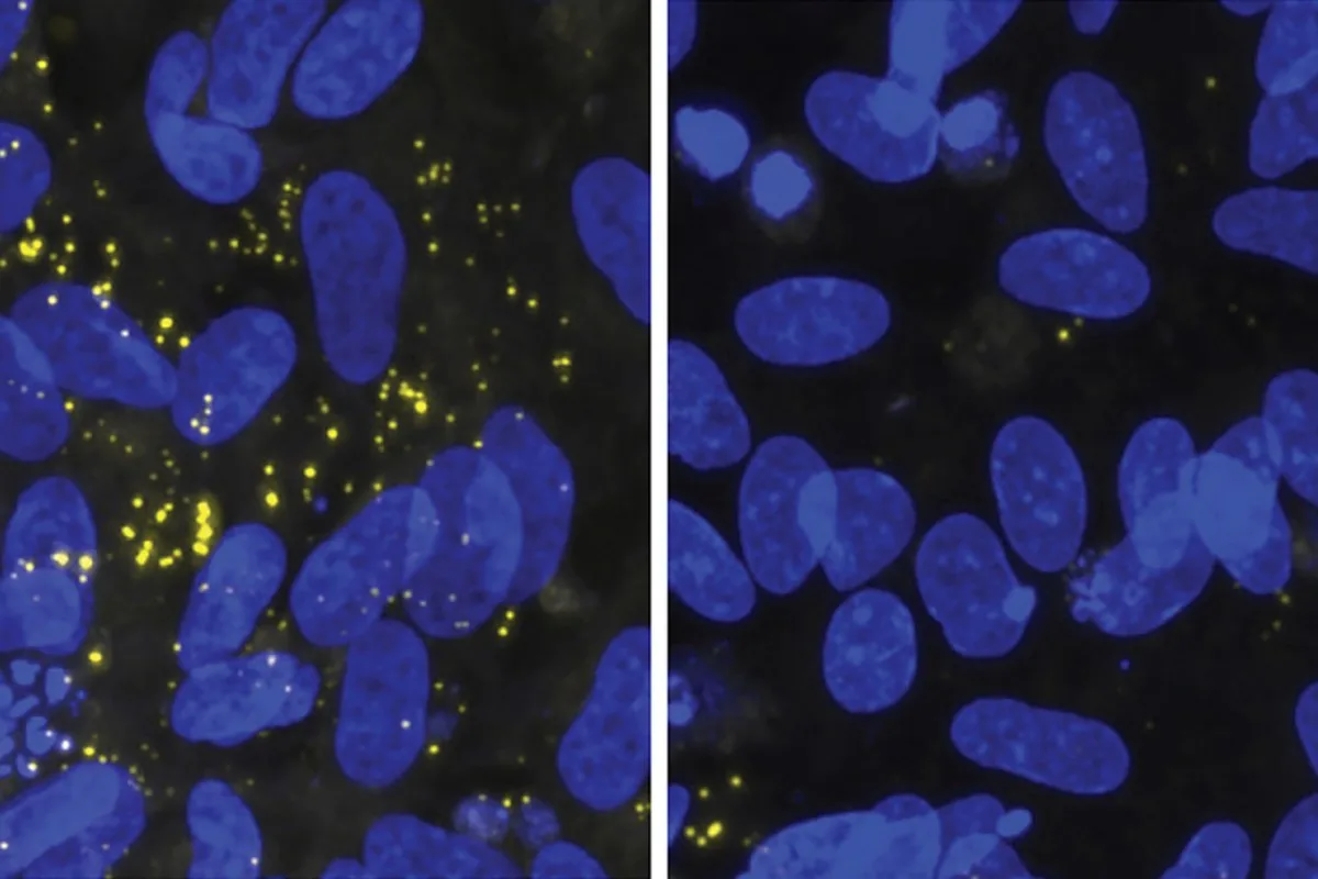 Two panels show blue cell nuclei on a black background. On the left, there are many more yellow speckles than on the right.