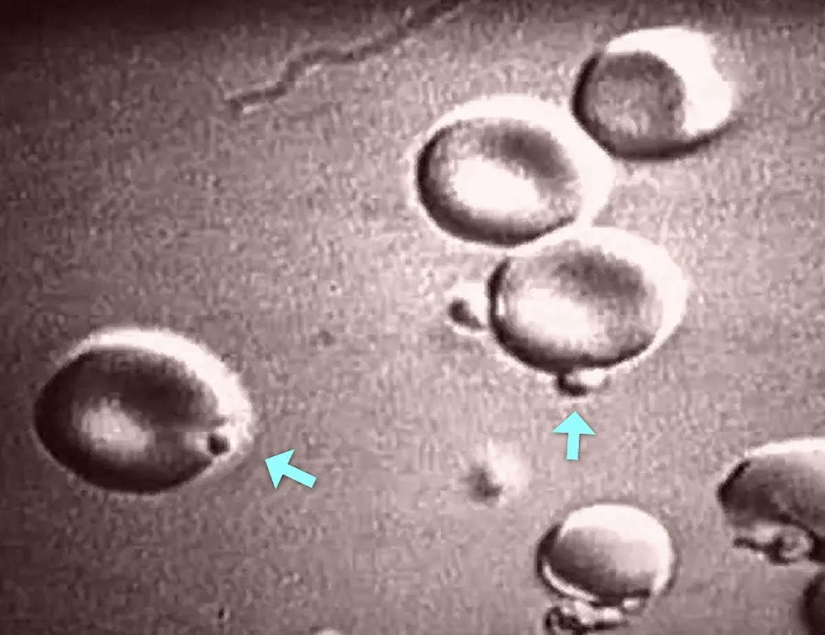 Malaria Parasite Caught in the Act of Breaking and Entering