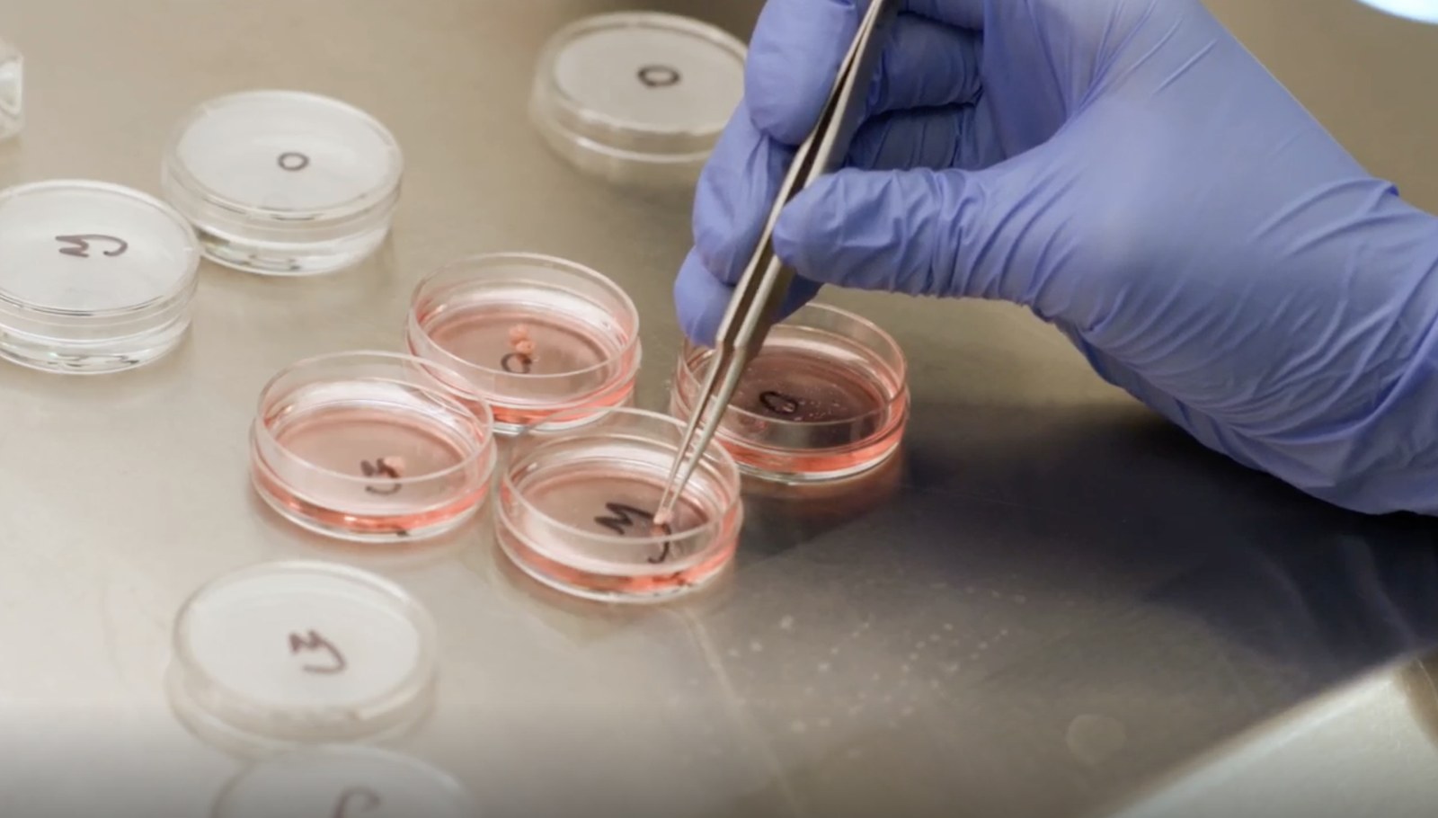Ovaries Develop an Intriguing Second Role After Menopause