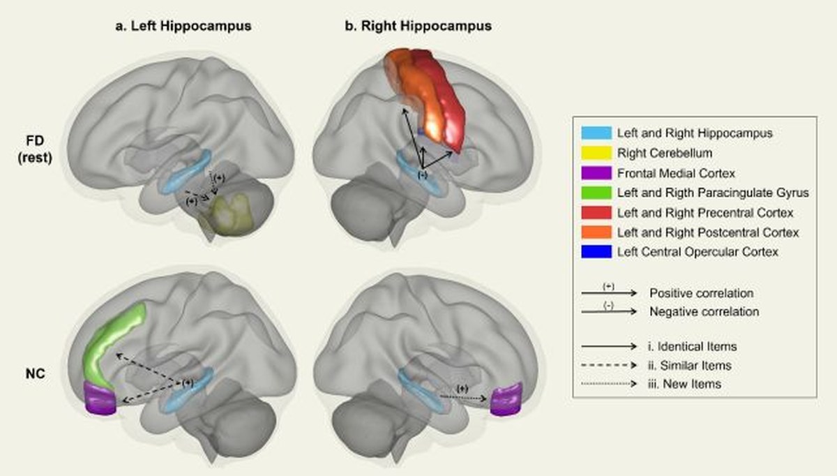 Freediving Seems to Reorganize The Human Brain on a Large Scale