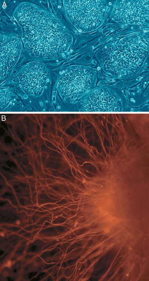 Human embryonic stem cells A: Stem cell colonies that are not yet differentiated. B: Nerve cells, an example of a cell type after differentiation.